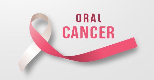 What You Need to Know About Oral Cancer
