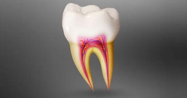 Everything You Need to Know About a Root Canal