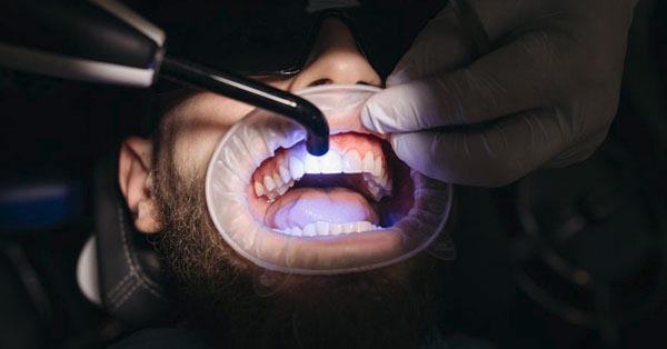 How to Extend the Results of Your Teeth Whitening Treatment