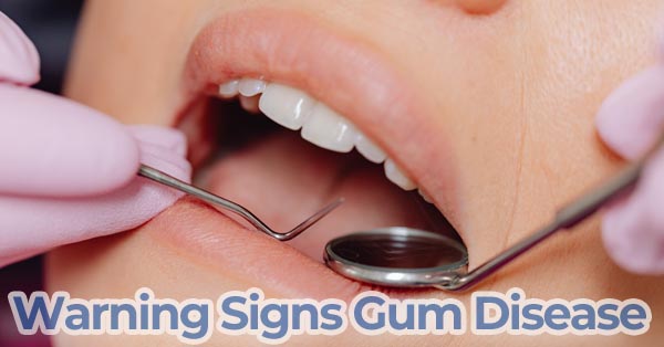 Warning Signs You Have Gum Disease